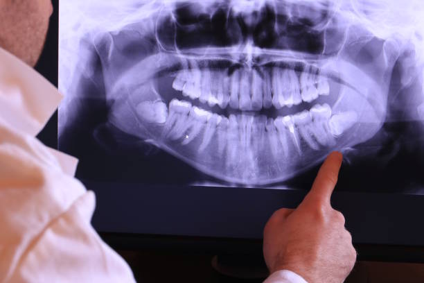 Best Emergency Dentist for Knocked-Out Tooth in Villas, NJ